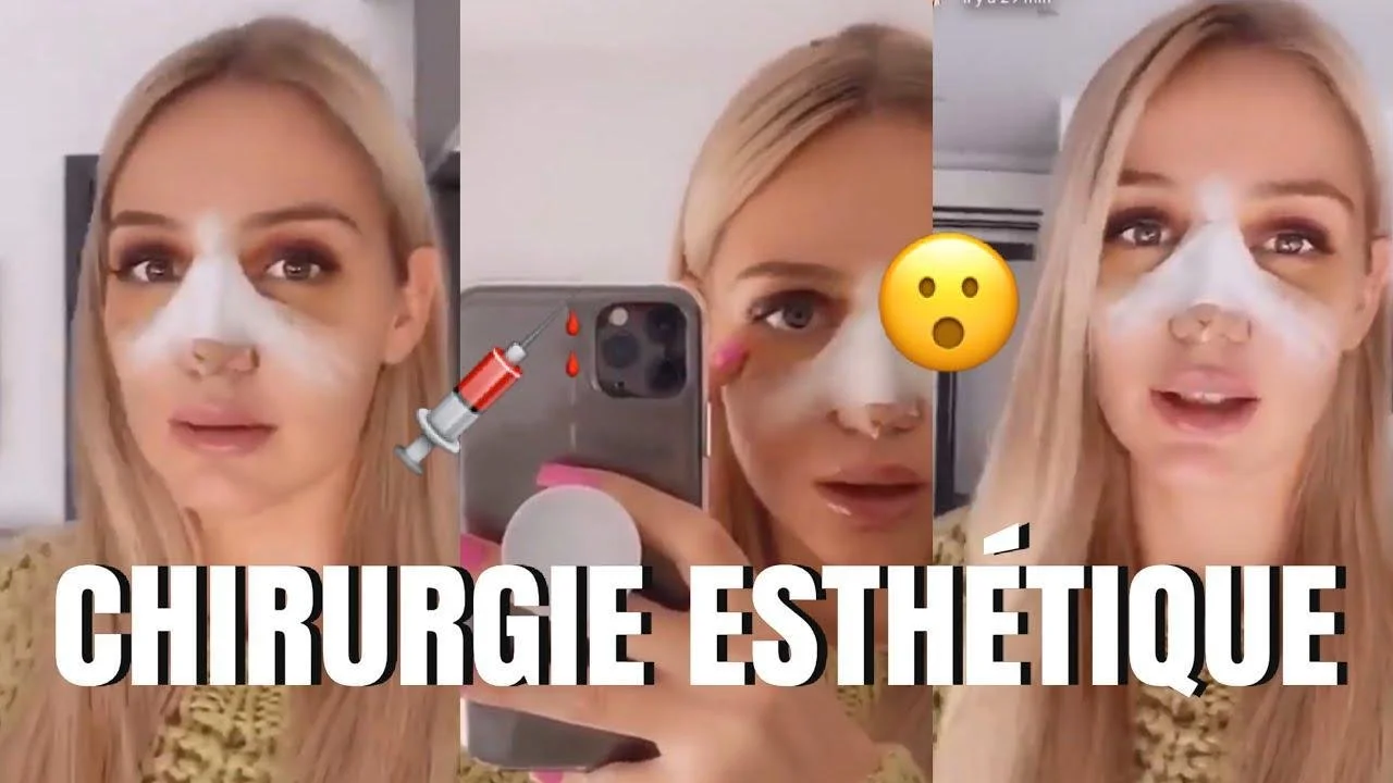 eloise appelle avant - Éloïse Appelle avant chirurgie : Découvrez le résultat de son opération ...
