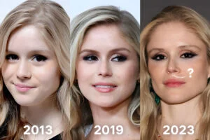 erin moriarty avant apres - Erin Moriarty avant apres evolution visage | Chirurgie Esthétique du ...