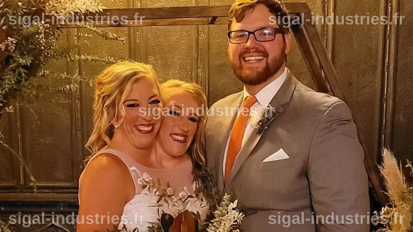 Les sœurs siamoises Abigail et Brittany enceinte : leur histoire