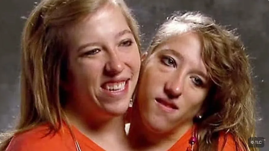 les sœurs siamoises abigail et brittany enceinte - Les célèbres sœurs siamoises, Abby et Brittany Hensel, sont-elles ...