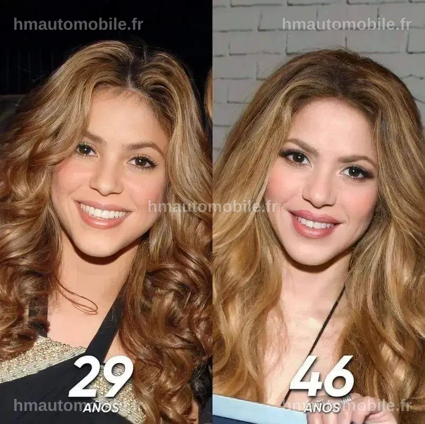 Shakira Chirurgie : Beauté et Controverse Dévoilées